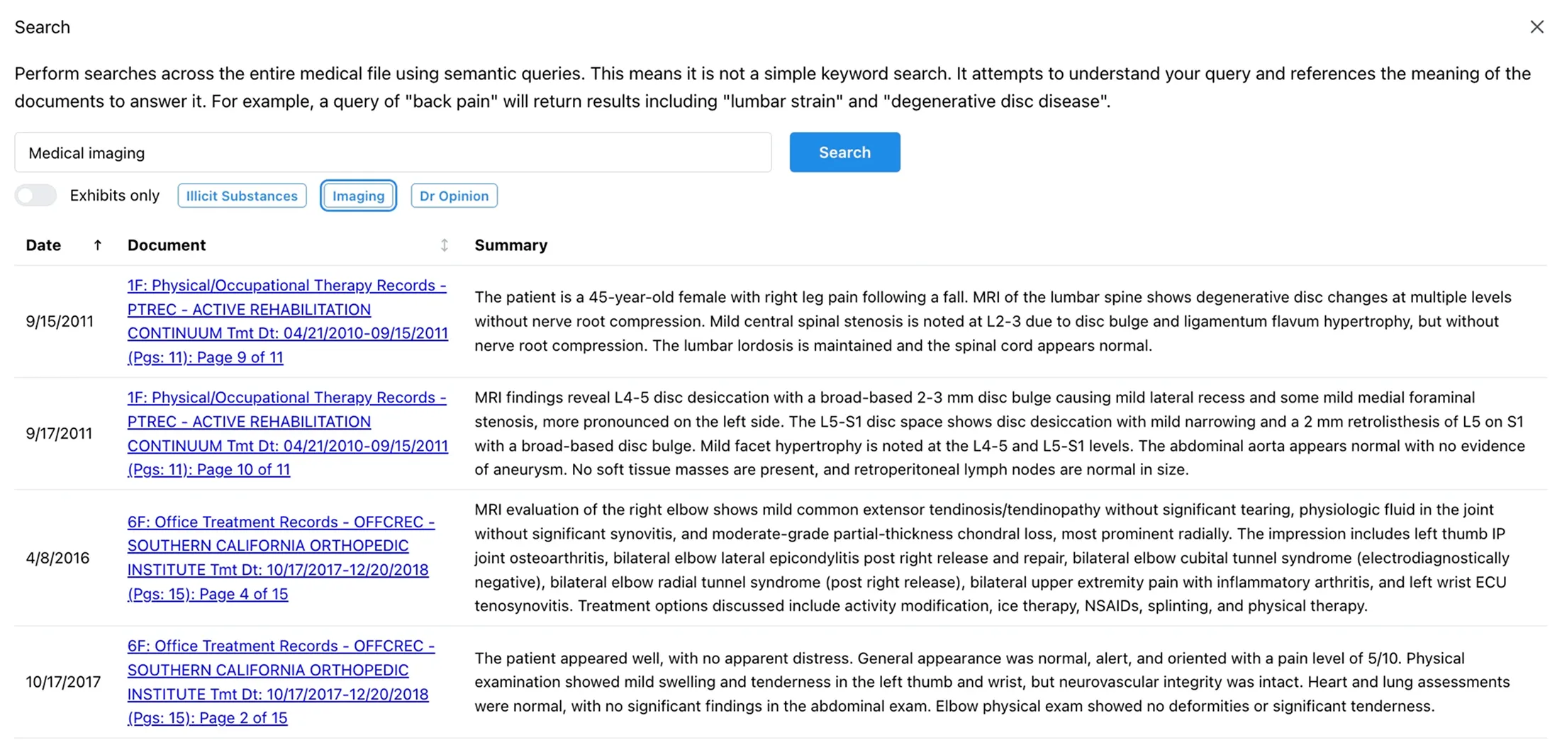 Chronicle AI-powered search interface